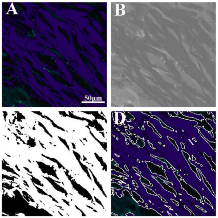 Four panels labeled A, B, C, and D. Panel A shows a microscopic image with purple elongated structures. Panel B displays a grayscale version. Panel C presents a black-and-white contrast version. Panel D shows the image with outlined contours. A scale bar indicates 50 micrometers.