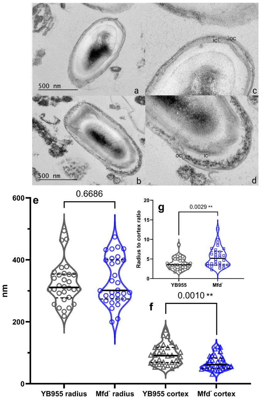 Electron micrographs (a-d) of bacterial cells showing detailed structures labeled with IC and OC. Panels (e-f) display violin plots comparing the radius, cortex measurements, and ratio of YB955 and Mfd' variants in nanometers, indicating statistical significance with values of 0.6686, 0.0010, and 0.0029 respectively.