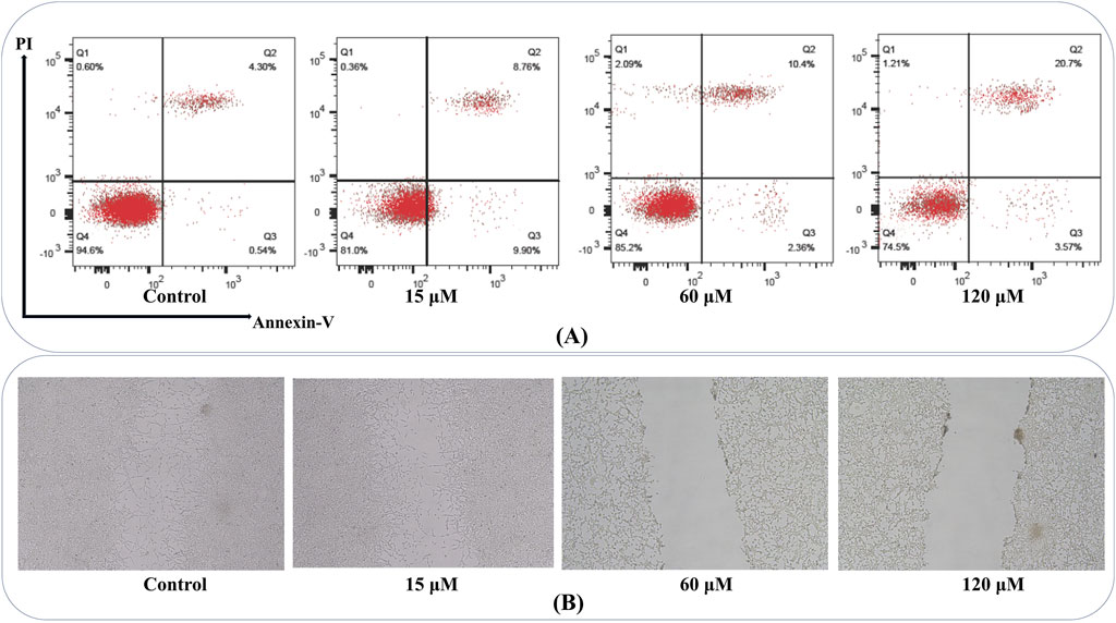 Panel A: Four flow cytometry scatter plots labeled Control, 15 µM, 60 µM, and 120 µM, respectively. Red dots indicate varying levels of Annexin-V and PI staining. Panel B: Four microscopic images showing wound closure after treatment with Control, 15 µM, 60 µM, and 120 µM conditions.