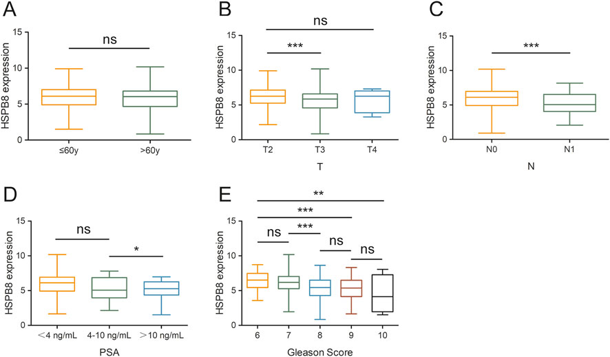 Box plots illustrate HSPB8 expression across various clinical parameters. Panel A: Age groups (≤60y vs. >60y) show no significant difference. Panel B: Tumor stages T2, T3, and T4 indicate significant variation between T2 and T3 (***). Panel C: Nodal status N0 vs. N1 shows significant difference (***). Panel D: PSA levels (<4 ng/mL, 4-10 ng/mL, >10 ng/mL) with significant difference between 4-10 ng/mL and >10 ng/mL (*). Panel E: Gleason scores 6 to 10 display several significant differences, with notable differences at higher scores. Statistical significance is marked as ns (not significant), * (p<0.05), ** (p<0.01), ***(p<0.001).