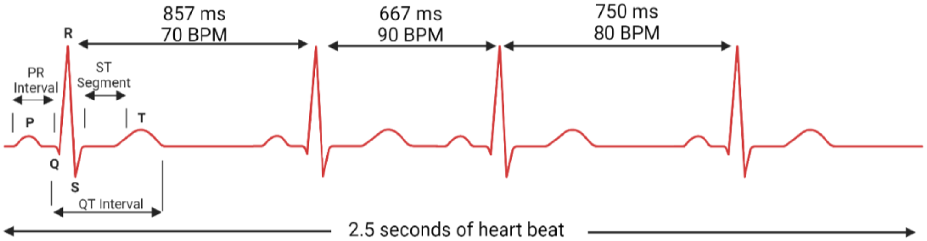 Electrocardiogram (ECG) waveform showing three heartbeats over 2.5 seconds. Labeled segments include the PR interval, QT interval, ST segment, and intervals with corresponding heart rates: 857 milliseconds at 70 beats per minute, 667 milliseconds at 90 beats per minute, and 750 milliseconds at 80 beats per minute.