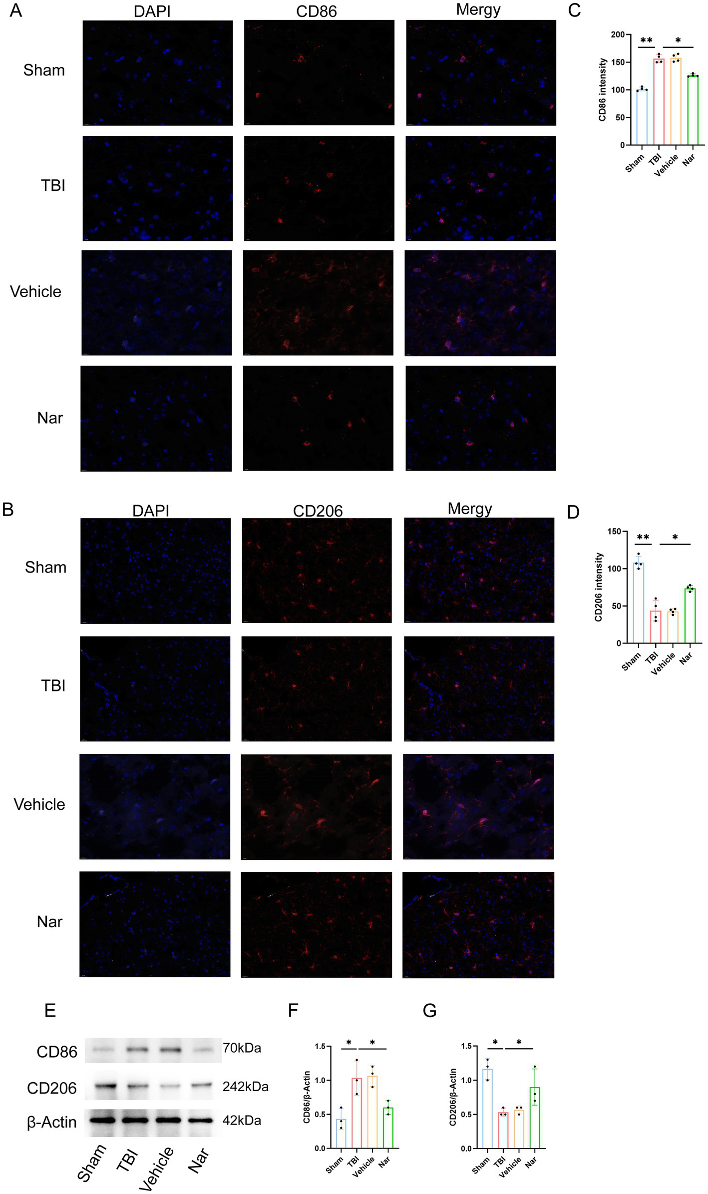 Fluorescence microscopy and Western blot analysis showing CD86 and CD206 expression in Sham, TBI, Vehicle, and Nar groups. Panels A and B depict immunofluorescence for CD86 and CD206 with DAPI. Panel C shows CD86 intensity data, and Panel D shows CD206 intensity data with significant differences marked by asterisks. Panel E displays Western blot images of CD86, CD206, and β-Actin. Panels F and G present quantification graphs of CD86/β-Actin and CD206/β-Actin ratios, respectively, with statistical significance annotated.
