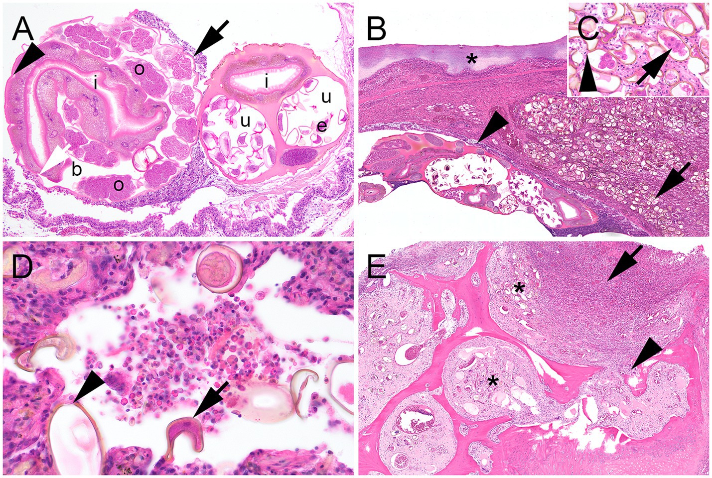 Histopathological lesions in a Harris’s Hawk (Parabuteo unicinctus) with Cyathostoma americana infection. Cross section of a female worm in the trachea shows cuticle, musculature, ovaries, uterus with eggs, and intestinal tract. Lung sections contain numerous thick-shelled operculated eggs with morulae in parabronchi, adult worms in bronchi, and thickened air sac membranes with necrosis, heterophils, and debris. Inflammatory cells, mainly macrophages and heterophils, are present in parabronchi with eggs. Body cavity shows osteomyelitis with bone resorption, woven bone, and parasitic eggs in the medullary cavity. Asterisks, letters and arrows are used as indicators for specific elements within each panel.