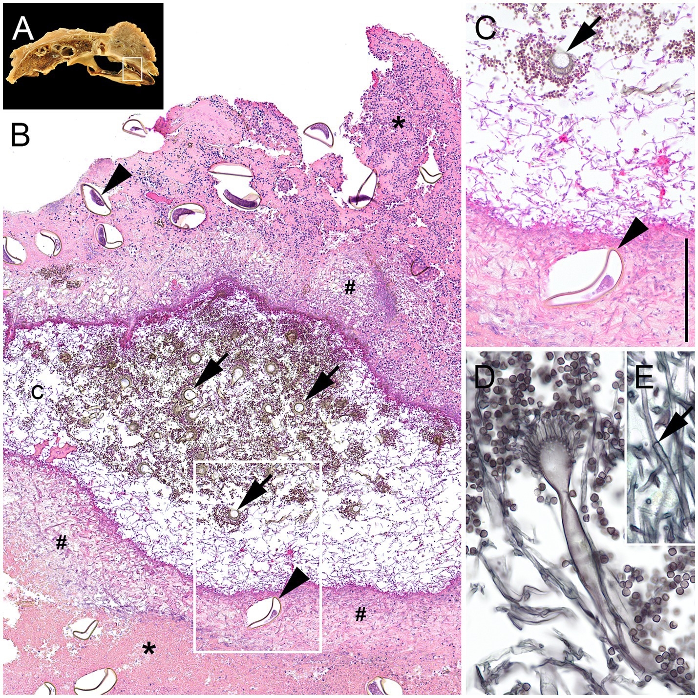 Histopathological lesions in a Harris’s Hawk (Parabuteo unicinctus) with Aspergillus fumigatus infection. Air sac membranes are markedly thickened and expanded by cellular debris and degenerated heterophils, containing numerous fungal hyphae, conidial heads, and free conidia. Thick-shelled parasitic eggs with morulae are embedded within debris and hyphae, forming central cavities filled with fungal elements. Higher magnification shows hyphae, conidial heads, and debris surrounding eggs. Detail views highlight sporulating A. fumigatus with prominent conidial heads and septate hyphae with parallel walls. Asterisks, hash keys, letter and arrows are used as indicators for specific elements within each panel.