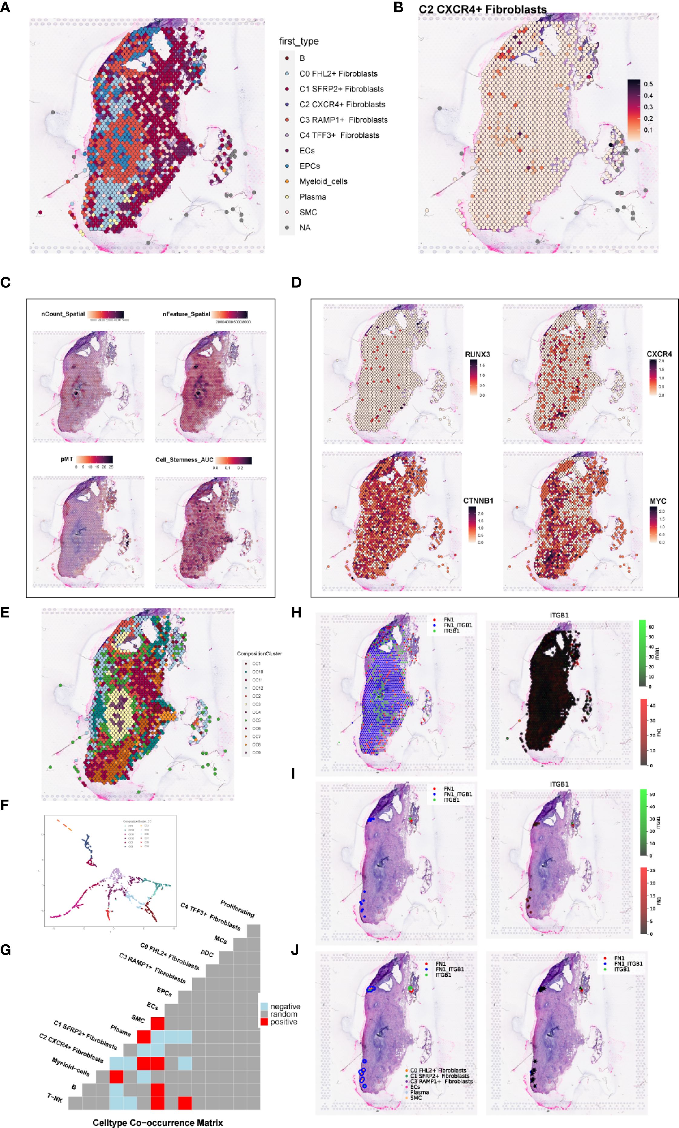 Composite image depicting various charts and visualizations of fibroblast cell data. Panel A shows a spatial distribution map with color-coded fibroblast types. Panel B highlights C2 CXCR4+ fibroblasts. Panel C features heatmaps for spatial count and features, including pMT score and Cell Stemness AUC. Panel D presents expression levels of RUNX3, CXCR4, CTNNB1, and MYC. Panel E displays cluster composition. Panel F is a scatter plot of cell types. Panel G shows a cell type co-occurrence matrix. Panels H, I, and J illustrate expression of FN1 and ITGB1 proteins, with color gradients indicating expression levels.