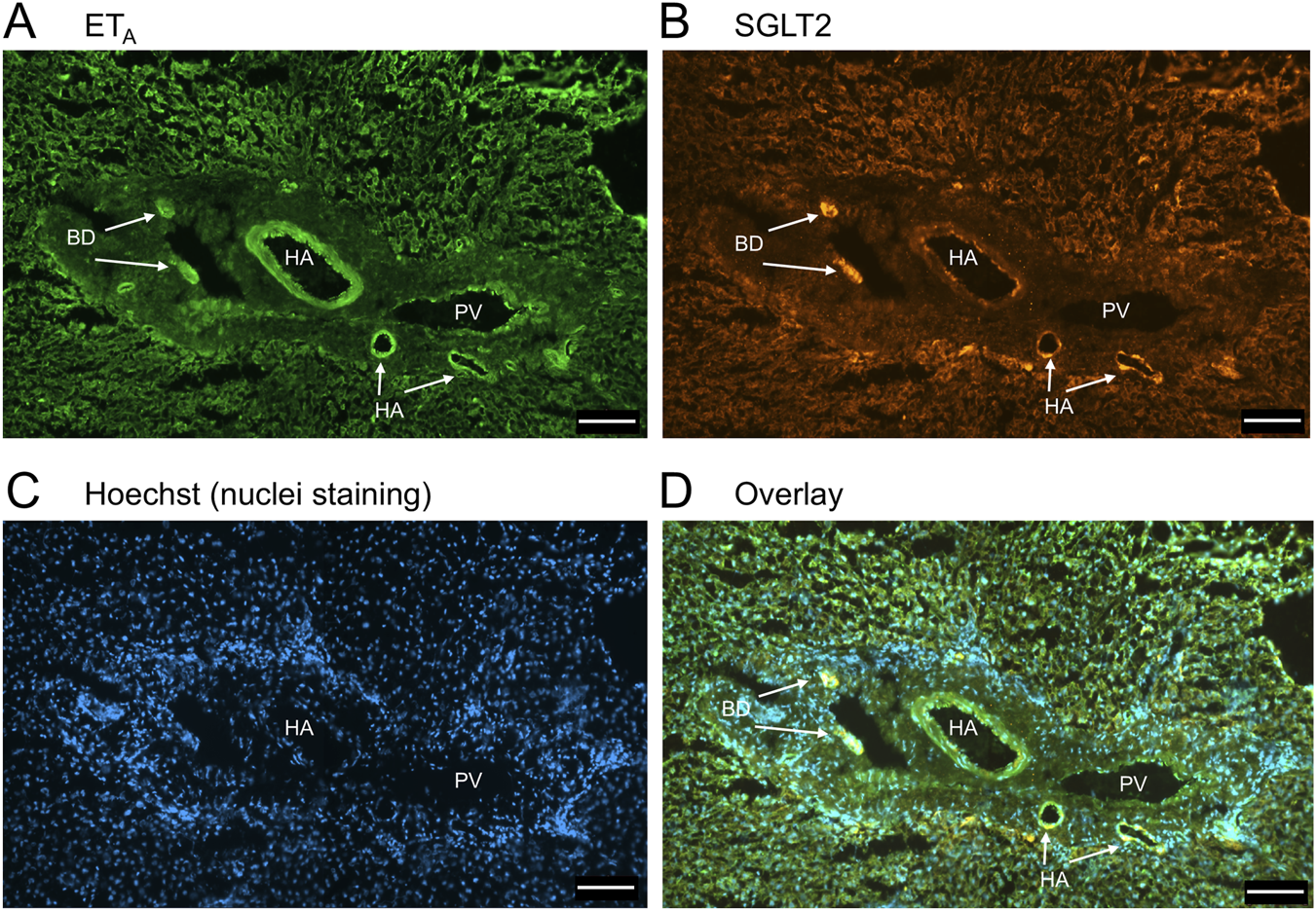 Four-panel microscopy image showing liver tissues with different staining techniques. Panel A displays green fluorescence for ETA, highlighting structures like bile ducts (BD), hepatic arteries (HA), and portal vein (PV). Panel B shows SGLT2 in orange, indicating similar structures. Panel C uses Hoechst stain for nuclei in blue. Panel D overlays these images, combining green, orange, and blue fluorescence for a comprehensive view of cellular structures including BD, HA, and PV. Scale bars are present in each panel for reference.