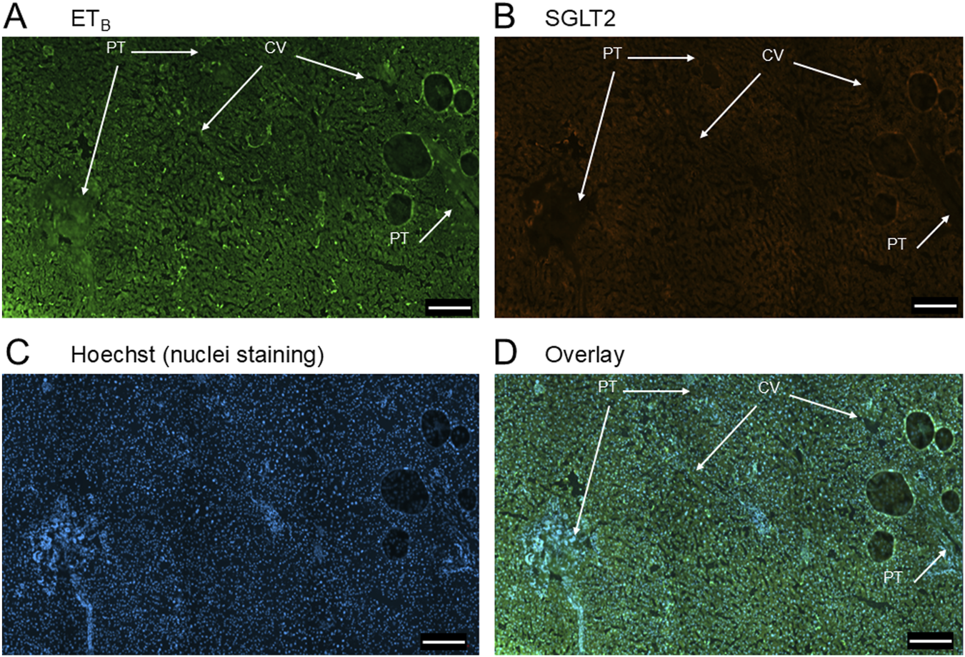 Panel A shows ETB receptor staining in green. Panel B displays SGLT2 staining in orange. Panel C shows nuclei stained with Hoechst in blue. Panel D overlays all three images, highlighting PT (portal tract) and CV (central vein) with arrows.