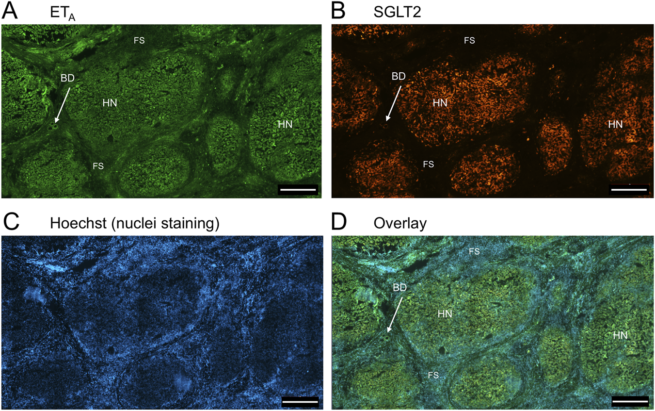Four panels showing fluorescent staining of a tissue sample. Panel A: ETA protein staining in green, highlighting structures labeled BD, HN, and FS. Panel B: SGLT2 protein staining in orange with similar structures annotated. Panel C: Hoechst nuclei staining in blue. Panel D: Overlay of the previous panels showing combined stains with labels BD, HN, and FS. Scale bars are present in each panel.
