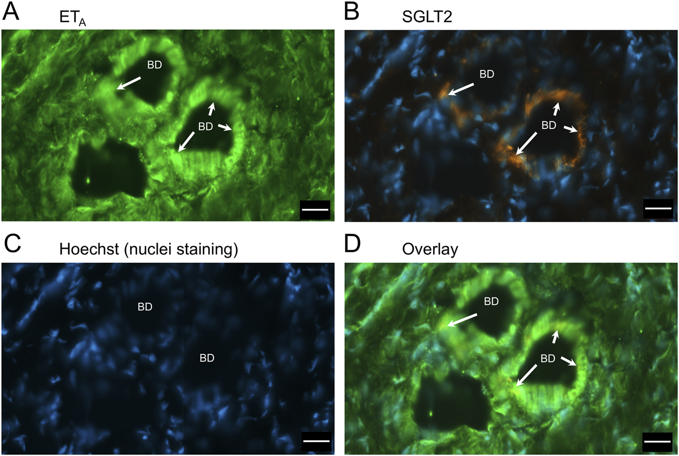 Four-panel image showing fluorescent microscopy of bile ducts (BD) in liver tissue. Panel A shows ETA staining in green. Panel B displays SGLT2 staining in blue and orange. Panel C presents nuclei stained with Hoechst in blue. Panel D overlays all stains, combining green, blue, and orange. Arrows indicate bile ducts in each panel.