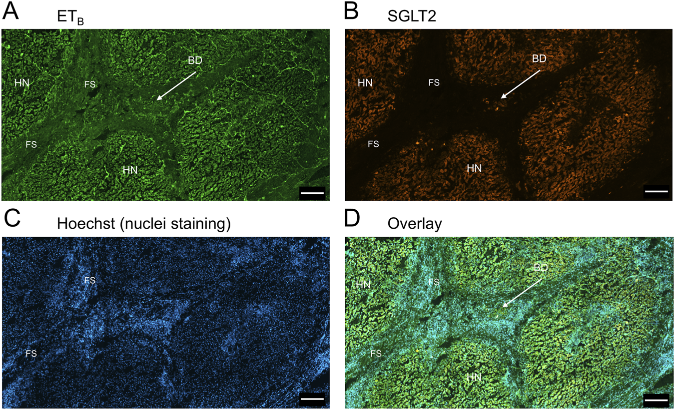 Fluorescent microscopy images showing tissue sections with different staining. A) Green staining for ETB indicating specific tissue regions. B) Orange staining for SGLT2 highlighting similar areas. C) Blue Hoechst staining showing nuclei distribution. D) Overlay of all three images, merging the labels to illustrate overall distribution. Labels indicate FS, HN, and BD regions.