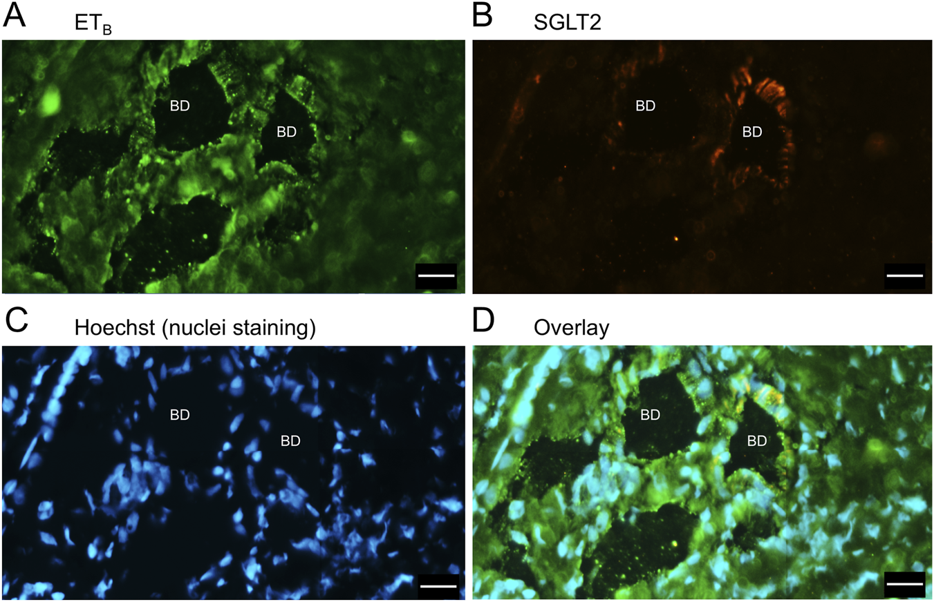 Panel A shows green fluorescence indicating ET\(_B\) receptor presence. Panel B shows orange-red fluorescence for SGLT2 expression. Panel C displays blue fluorescence for Hoechst-stained nuclei. Panel D overlays the images, combining the green, orange-red, and blue signals. “BD” labels bile duct areas in each panel.