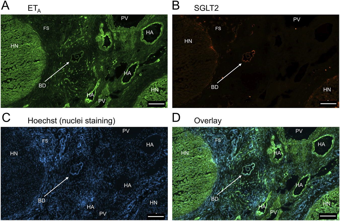 Panel A shows immunofluorescence of ETA in green, highlighting the bile duct (BD). Panel B displays SGLT2 staining in orange, also pointing to the BD. Panel C illustrates nuclei staining with Hoechst in blue. Panel D is an overlay combining the previous stains, merging green, orange, and blue hues, highlighting the structures labeled as BD, HN, FS, PV, and HA. Each panel includes a scale bar for reference.