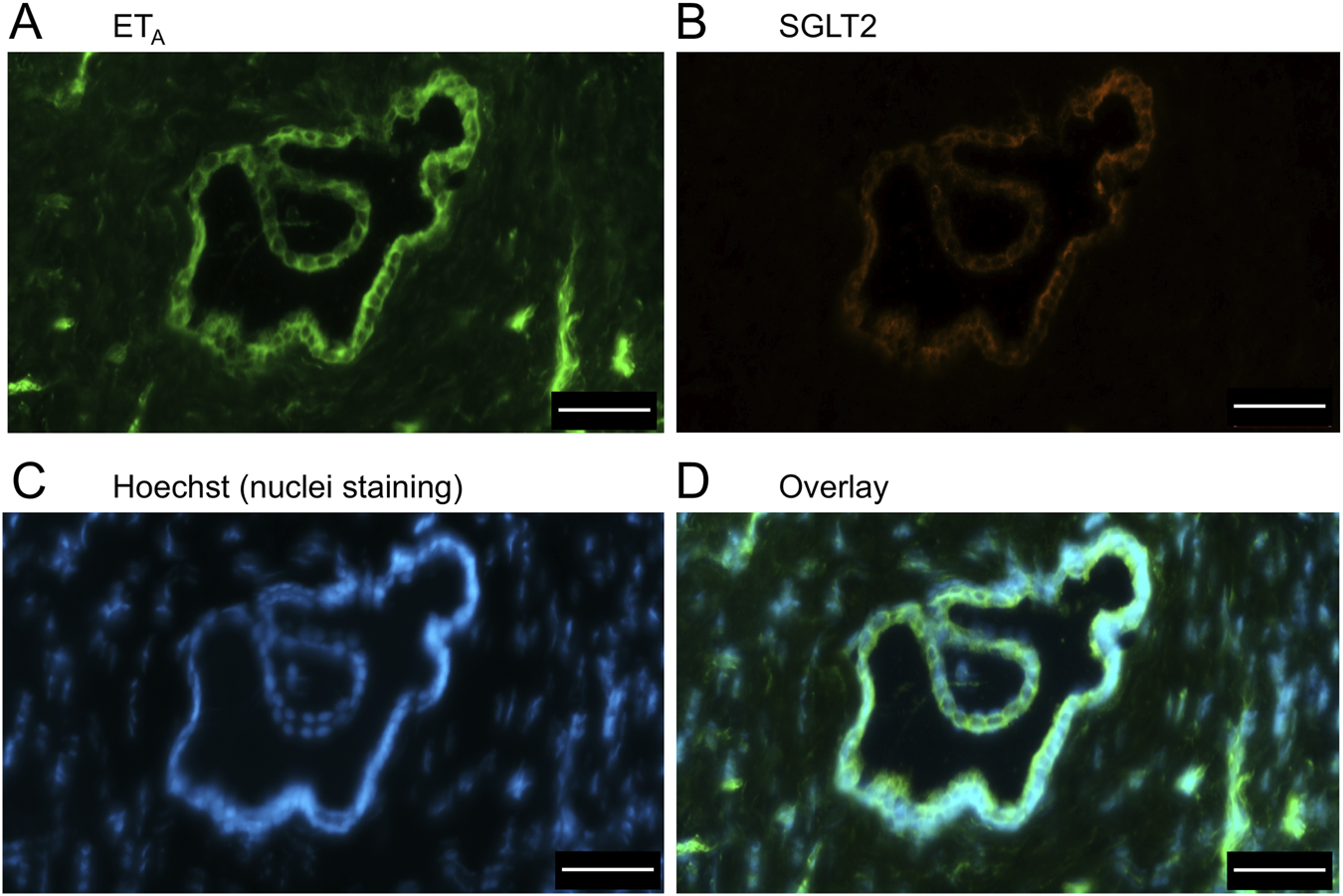 Four panels show fluorescent microscopy images of tissue sections. A: ETa receptor in green. B: SGLT2 protein in orange. C: Nuclei stained with Hoechst in blue. D: Overlay of all images. Scale bars are present.