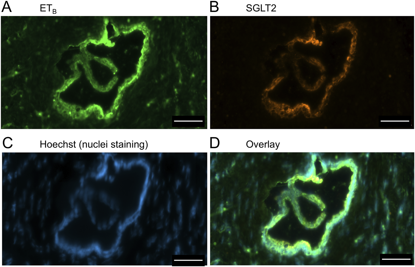 Panel of four fluorescent microscopy images showing different staining of a tissue section. A: ET\(_B\) receptor in green. B: SGLT2 in orange. C: Hoechst nuclei stain in blue. D: Overlay combining all stains, highlighting colocalization. Scale bars are present.