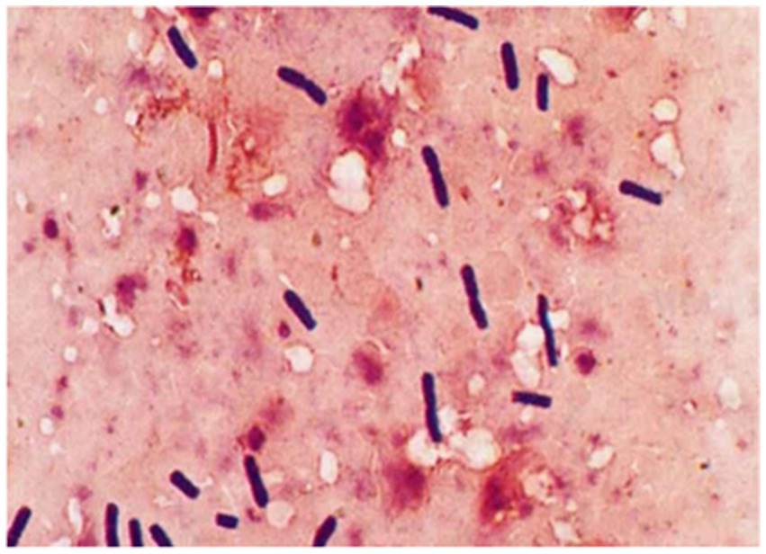 Microscopic view showing rod-shaped bacteria stained dark against a pink background. The image appears to have clusters of varying sizes scattered throughout.