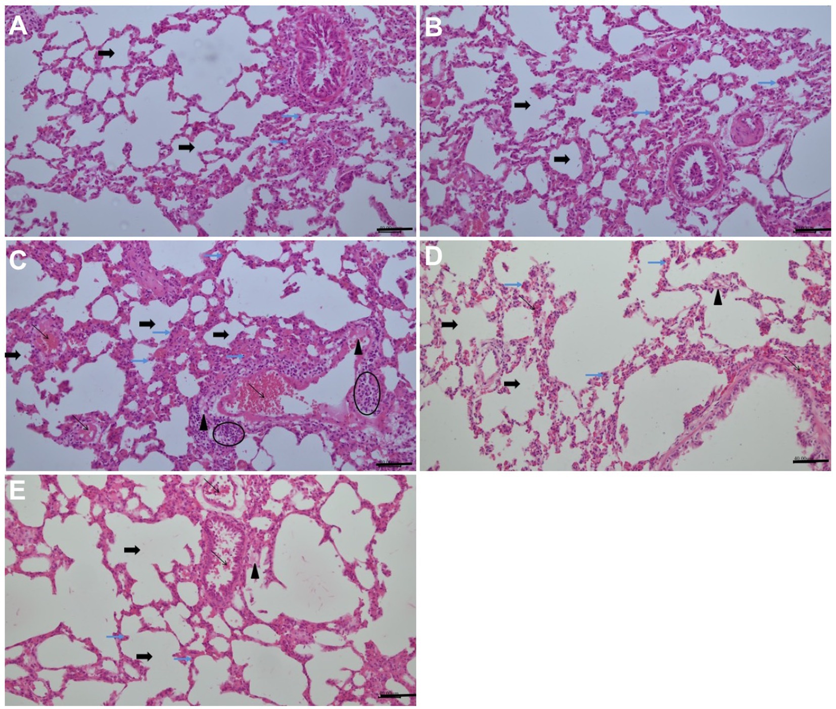 Microscopic images of lung tissue sections labeled A to E, stained in pink and purple. Arrows indicate regions of interest, showing variations in alveolar structure and cellular density. Some panels have circled areas and annotations with arrowheads noting specific features of the tissue.