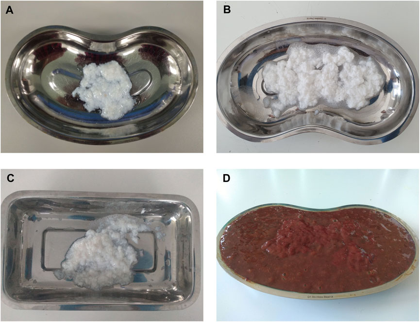 Four kidney-shaped stainless steel trays labeled A, B, C, and D contain different substances. Tray A shows a small amount of white, thick substance. Tray B contains a larger quantity of fluffy white material. Tray C holds a smaller portion of a similar white substance. Tray D is filled with a thick, brown, granular mixture.