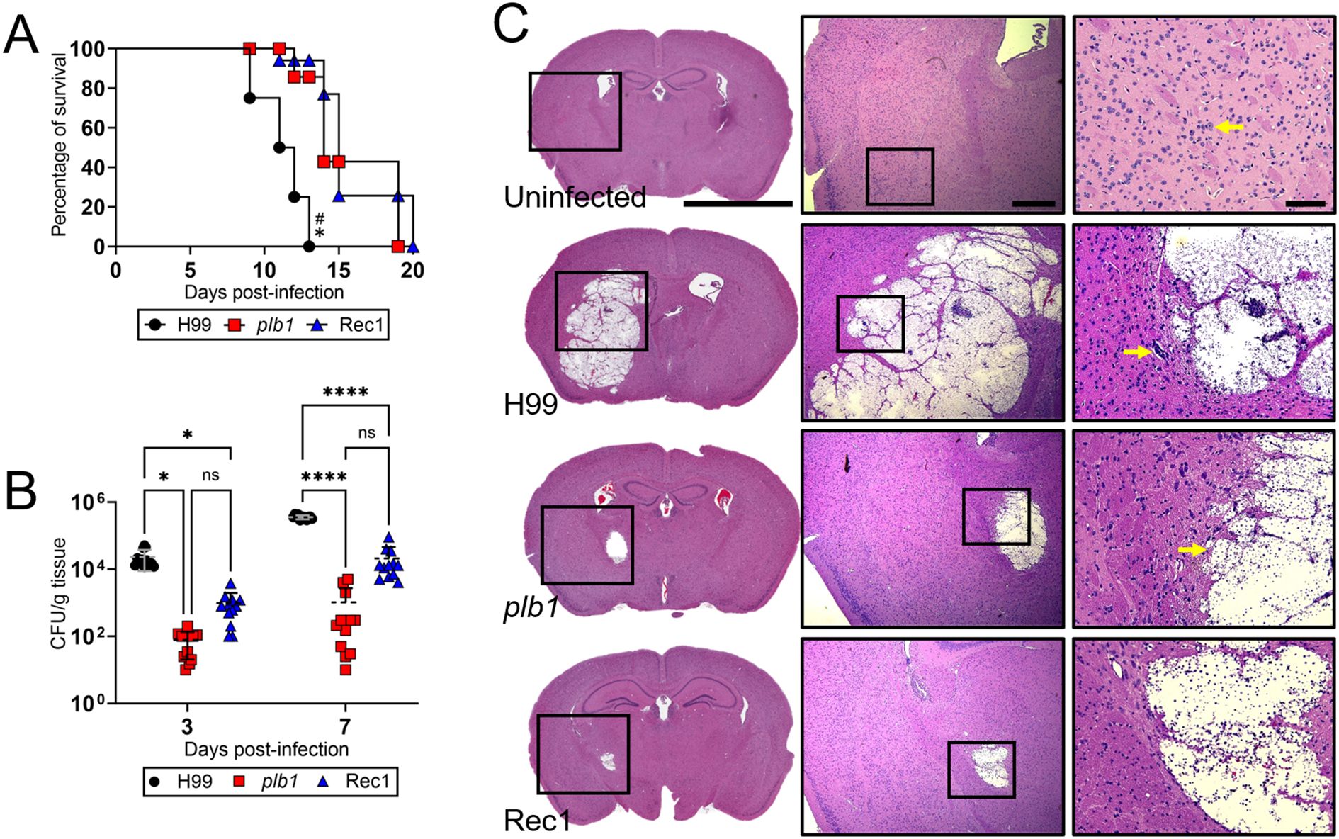 Graph A shows survival percentages over 20 days post-infection for H99, plb1, and Rec1 groups, with H99 showing the lowest survival. Graph B presents CFU per gram of tissue on days three and seven post-infection, indicating varying colony counts among groups, with significant differences indicated. Panel C displays histological brain sections from uninfected, H99, and plb1, and Rec1 groups, highlighting tissue changes and fungal presence, with notable structures marked by yellow arrows.