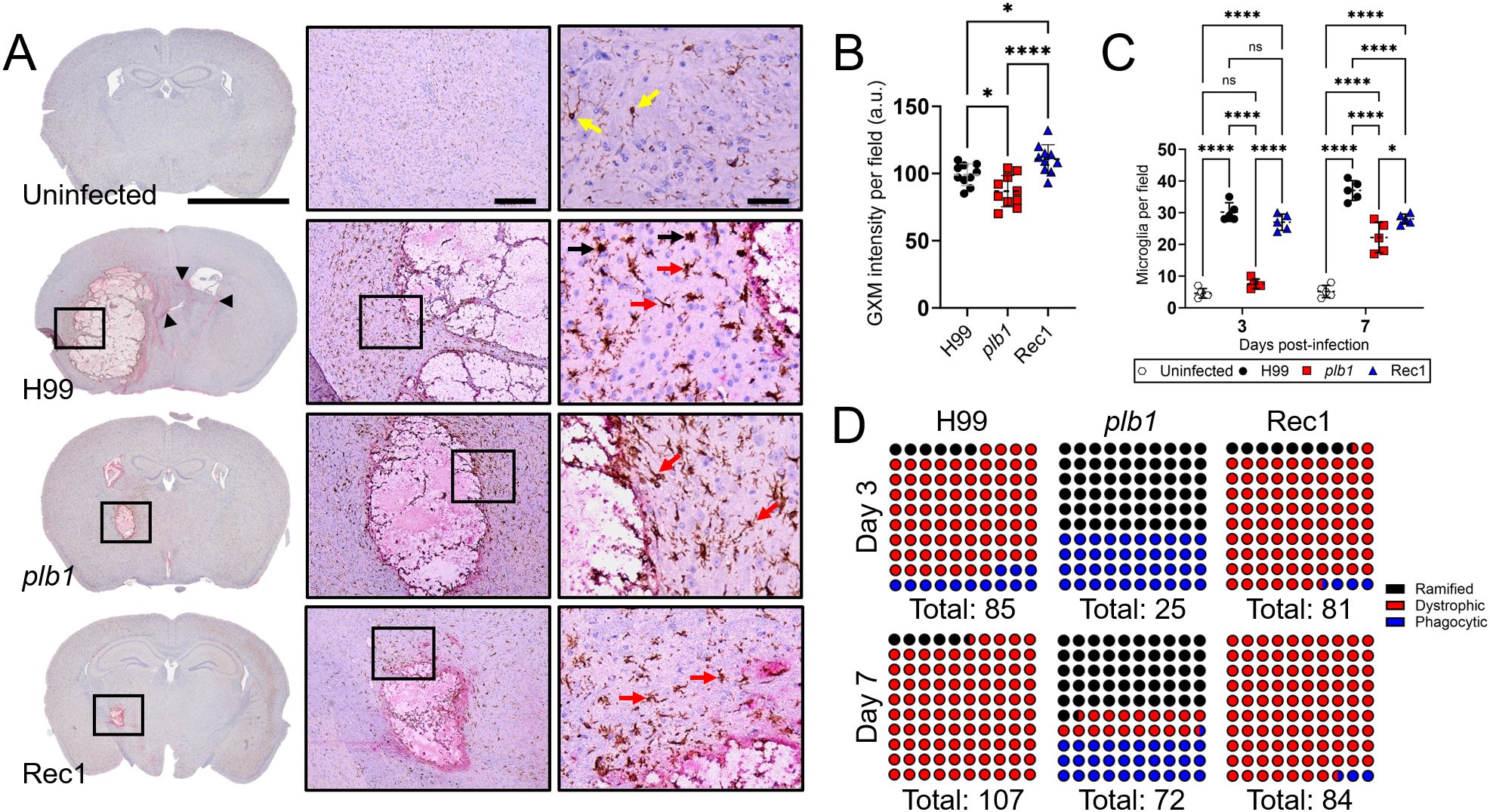 Panel A shows histological brain tissue sections comparing uninfected, H99 infected, *plb1*, and Rec1 conditions, highlighting differences in staining. Panels B and C display graphs comparing GXM intensity and microglia count per field, respectively, over time for different conditions. Panel D presents a visual representation of microglia morphologies (ramified, dystrophic, phagocytic) in conditions H99, *plb1*, and Rec1 at day 3 and day 7 post-infection. Statistical significance is indicated with asterisks, and a legend clarifies symbols used.