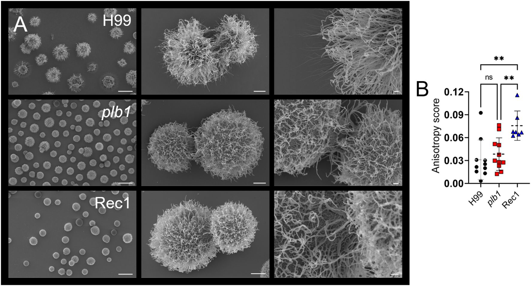 Three sets of scanning electron microscope images display fungal colonies labeled H99, plb1, and Rec1. Each set includes a wide view, close-up, and detail of the colony surface structure. Adjacent, a graph presents anisotropy scores for each type, showing significant differences with statistical annotations.