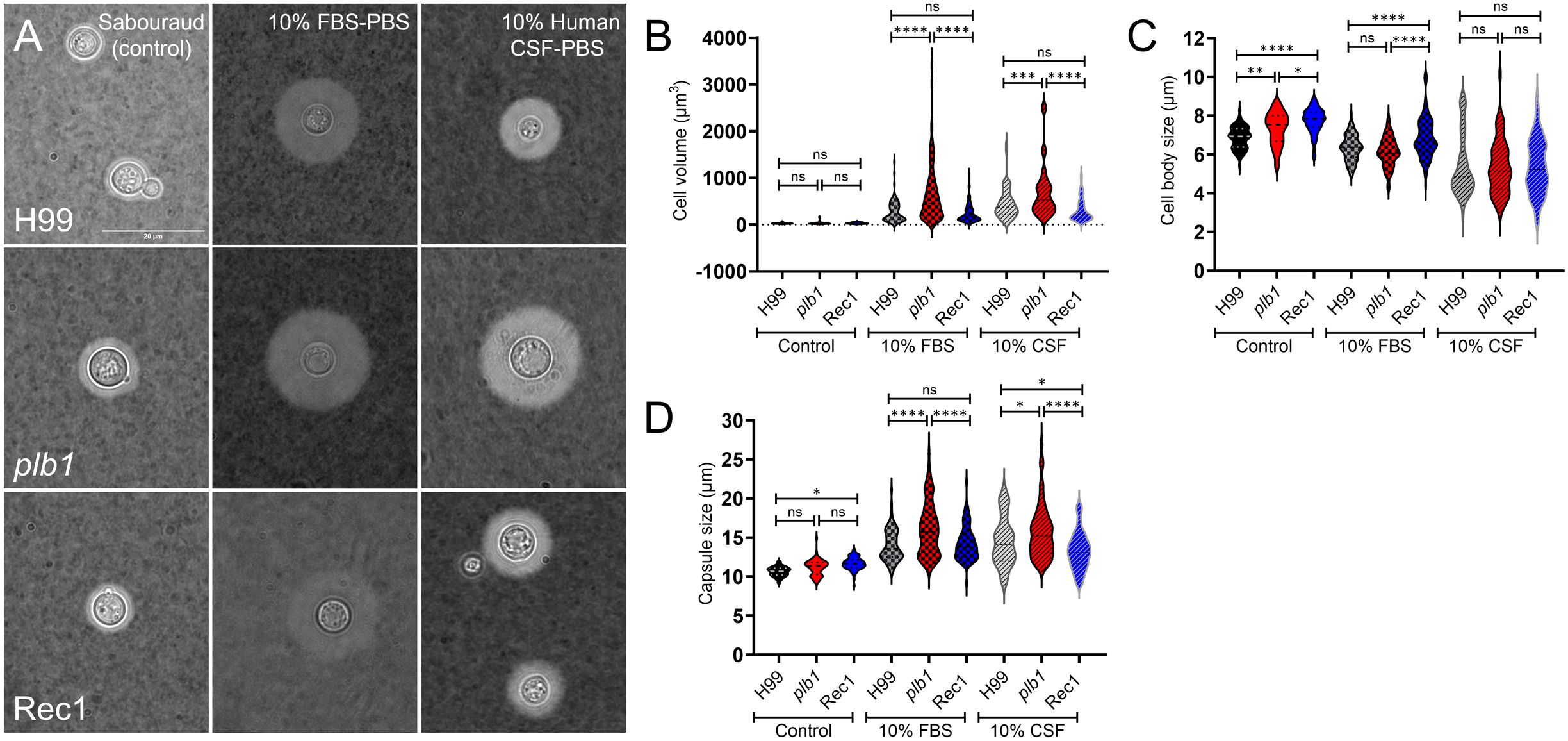Panel A shows microscopic images of H99, plb1, and Rec1 cells under Sabouraud, 10% FBS-PBS, and 10% Human CSF-PBS conditions. Panel B displays violin plots comparing cell volumes in various conditions, with significant differences indicated. Panel C presents cell body sizes, showing significant differences, while Panel D illustrates capsule size measurements, highlighting significant differences across conditions.