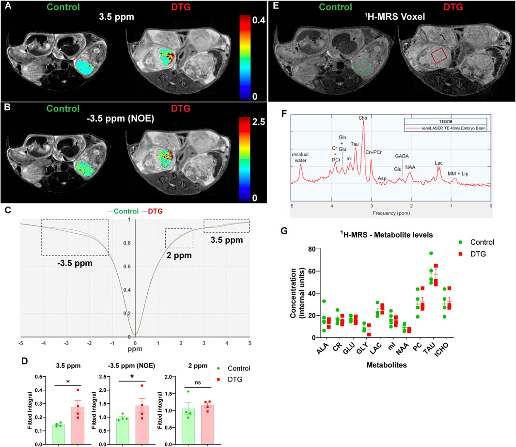 MRI and spectroscopy images display comparisons between control and DTG groups using color-coded overlays. Panels A and B show metabolite maps at different ppm settings. Panel C presents a graph comparing chemical shifts. Panel D shows bar graphs of fitted integrals. Panel E features voxel location images for spectroscopic analysis. Panel F presents a frequency spectrum highlighting metabolite peaks. Panel G contains a scatter plot showing metabolite concentration levels in control and DTG samples. The overall focus is on biochemical differences indicated by color gradients and labeled axes.