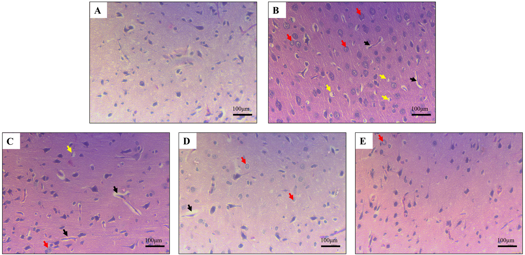 Microscopic images labeled A to E show brain tissue sections stained using HE staining, depicting varying morphology and structures. Image A has a sparse distribution. Image B shows dense cellular presence, highlighted with red, yellow, and black arrows indicating specific features. Image C has notable features marked with arrows. Image D displays a moderate density with red and black arrow markers. Image E shows a clearer section with red arrow markers. Each image includes a scale bar denoting one hundred micrometers.