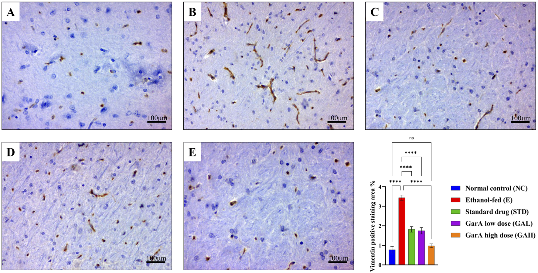 Histological images labeled A to E showing tissue with various levels of Vimentin staining, likely indicating different treatments. The scale bar in each image measures one hundred micrometers. Below, a bar graph displays the percentage of vimentin positive staining for different groups: Normal control (NC), Ethanol-fed (E), Standard drug (STD), GarA low dose (GAL), and GarA high dose (GAH) with significance levels noted.