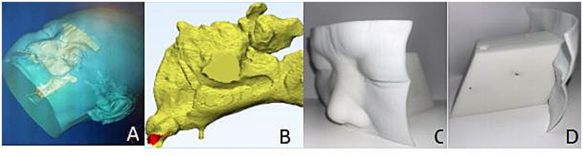 Four-panel image labeled A to D. A: 3D scan of a human head viewed from the side, with internal structures visible. B: Yellow 3D model of a complex bone structure, possibly a joint. C: White 3D printed model of a human face, focusing on the brow and nose area. D: White 3D printed object with a flat surface and curved edges, resembling a section of a protective shell or mask.