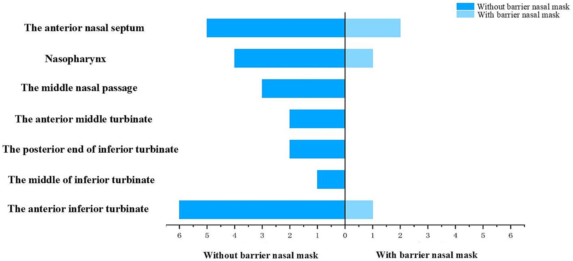 Bar chart comparing nasal regions with and without a barrier nasal mask. Dark blue represents no mask and light blue represents a mask. The anterior nasal septum has the highest value without a mask, around 6 units, while with the mask, values are significantly lower in all regions.