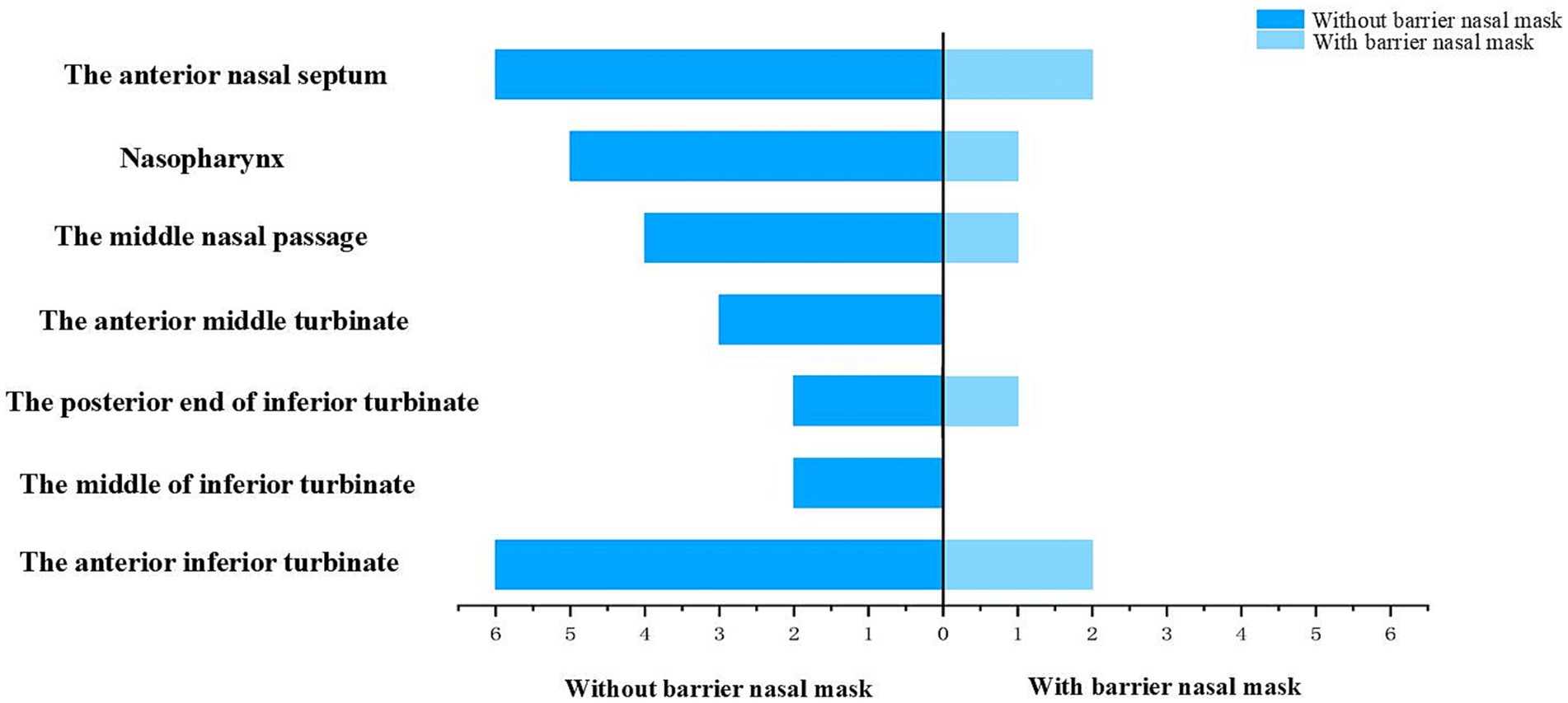 Bar chart comparing air pressure differences in various nasal regions with and without a barrier nasal mask. Categories include the anterior nasal septum and nasopharynx. Dark blue bars represent without a mask, and light blue with a mask.