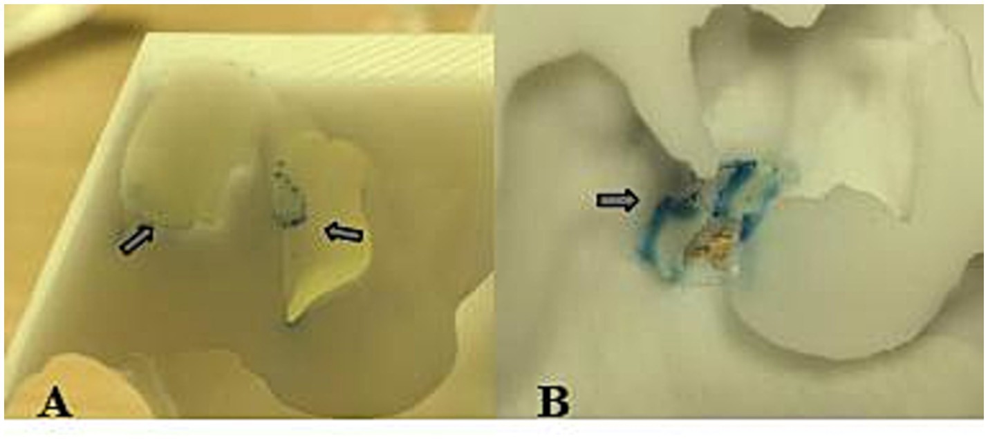 Two panels labeled A and B show close-up views of light-colored surfaces with arrows pointing to specific areas. In panel A, the arrows highlight light patches, while in panel B, the arrow indicates a blue-stained area on the surface.
