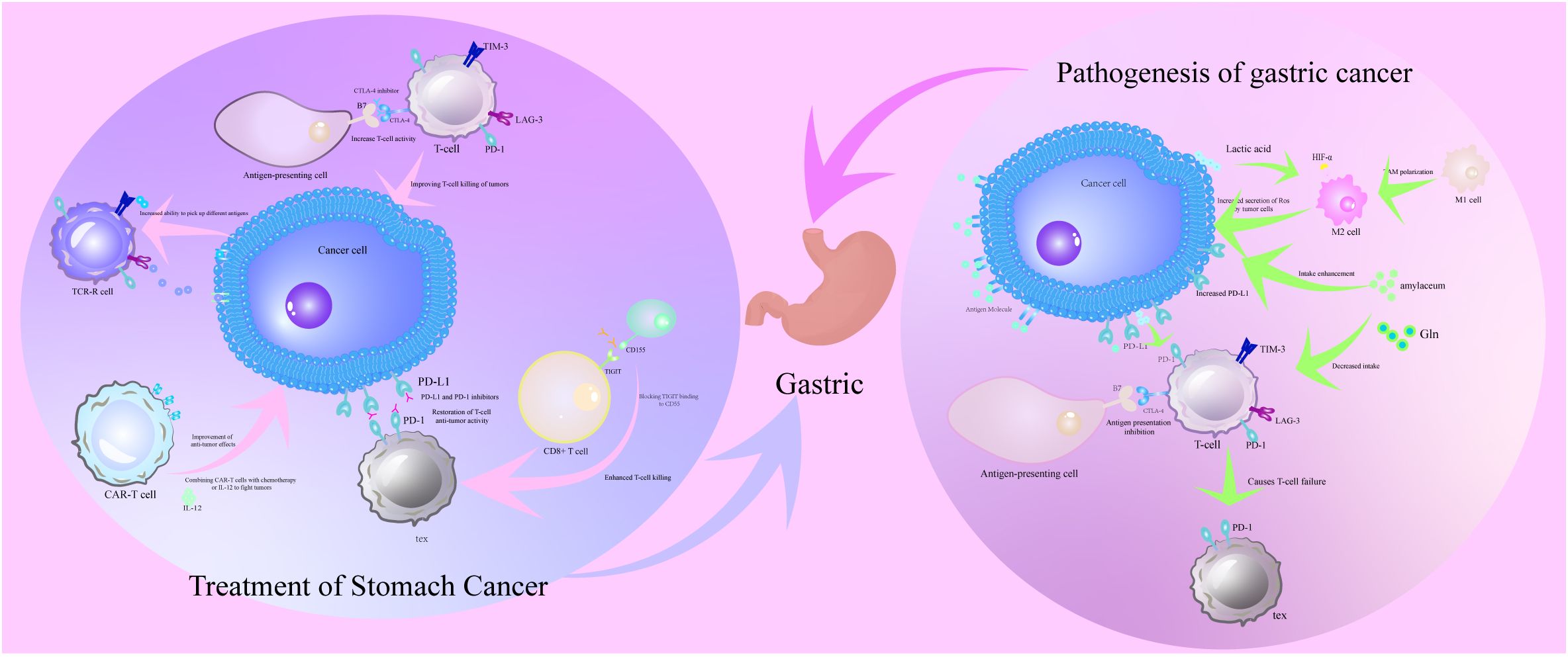 Illustration comparing the pathogenesis and treatment of gastric cancer. The left side depicts treatment strategies involving T cells, CAR-T cells, and inhibitors to enhance anti-tumor effects. The right side shows the pathogenesis, highlighting cancer cell interactions, increased PD-L1, antigen presentation inhibition, and the effects of M1 and M2 cells. Arrows indicate different interactions and mechanisms, with labels for various proteins and cells involved. A small stomach icon is centered between the two sections.