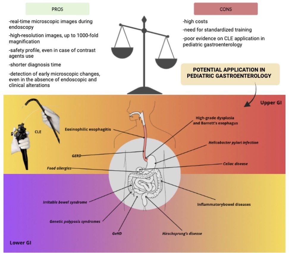 Diagram depicting the pros and cons of using CLE in endoscopy, highlighting its benefits in real-time imaging and short diagnosis time. It also shows potential applications in upper and lower gastrointestinal issues, including eosinophilic esophagitis, GERD, food allergies, various bowel syndromes, and infections. A balanced scale illustration suggests weighing pros and cons, and a hand holds CLE equipment. There's a note on potential applications in pediatric gastroenterology.