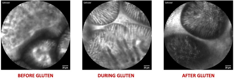 Three grayscale microscope images labeled \
