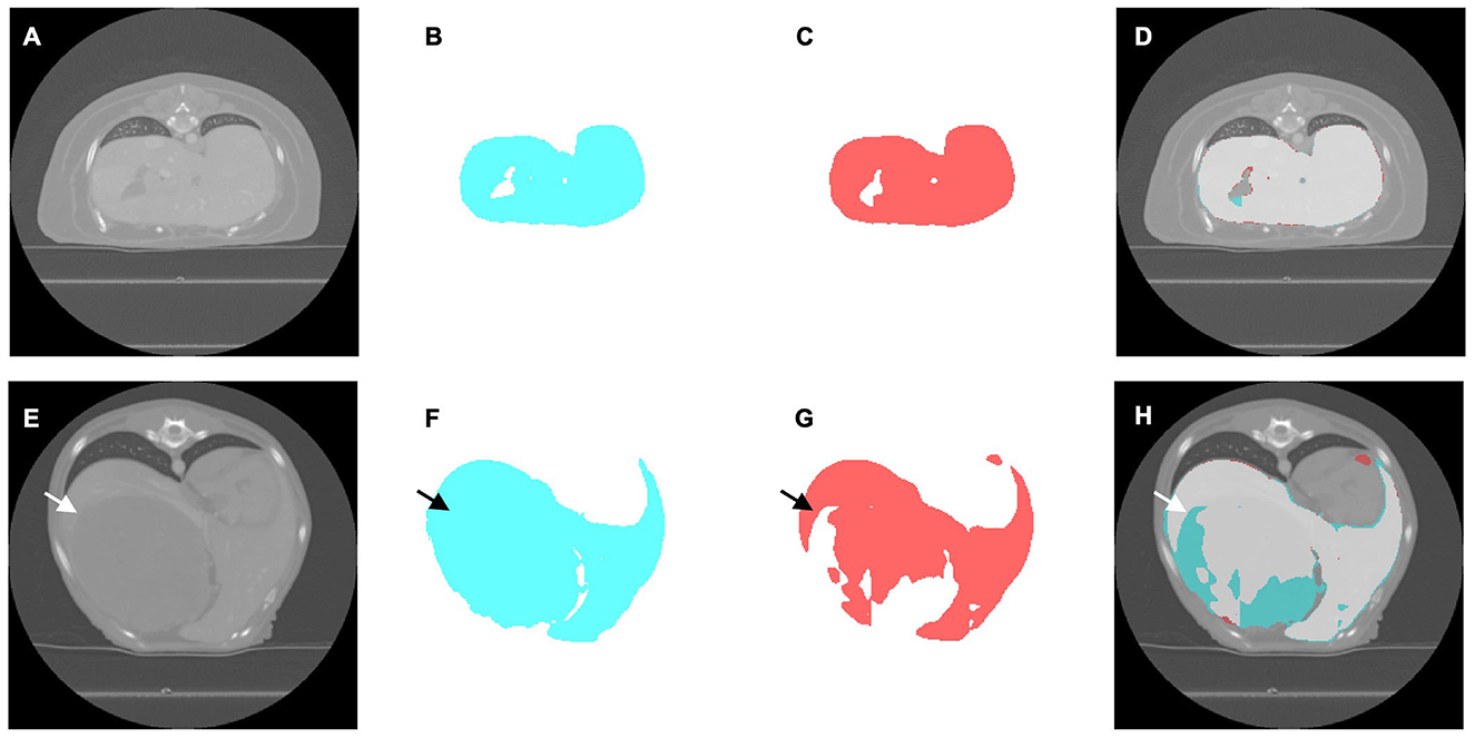 Eight panels comparing liver segmentation on canine abdominal CTs. The top row (A-D) shows a case without a hepatic mass; the bottom row (E-H) shows a case with a mass, indicated by arrows. For each case, the original CT (A, E) is shown with the expert-drawn ground truth (cyan, B, F) and the model's prediction (red, C, G). The final panels (D, H) are overlays that compare the accuracy of the model’s prediction (red) against the ground truth (cyan) on the original scan.