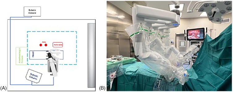 Diagram and photo of a robotic surgical setup. The diagram (a) shows positions of the robotic console, anesthesiologist's corner, and surgical table layout with labeled axes. The photo (b) depicts a surgical robot in an operating room, with robotic arms and medical equipment covered in sterile green drapes. A monitor displays a surgical view.
