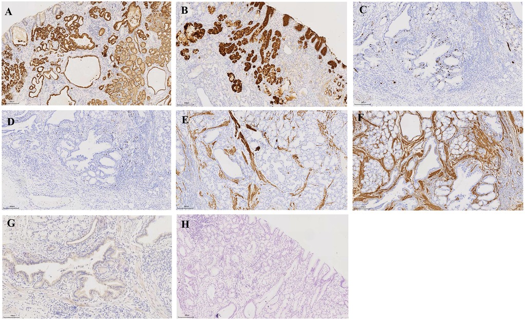 Microscopic images of tissue samples identified by letters A to H. Each panel shows varying degrees of staining, indicating different levels of expression or presence of a specific protein or marker. The patterns and intensity of staining differ, suggesting different pathological or physiological conditions within the tissues.