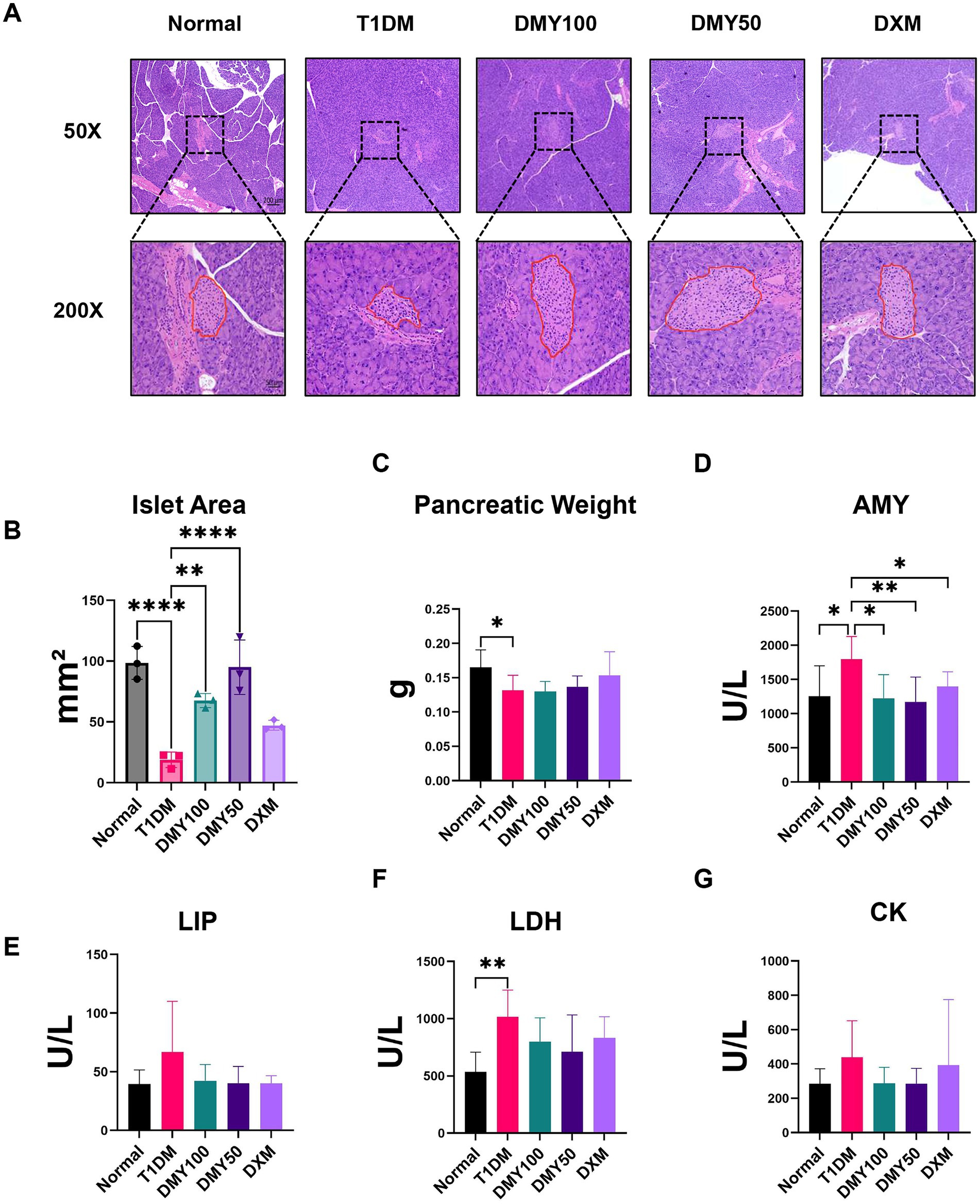 Panel A shows histological images of pancreatic tissue at magnifications of fifty times and two hundred times for Normal, T1DM, DMY100, DMY50, and DXM groups. Panels B to G present bar graphs comparing islet area, pancreatic weight, and enzyme levels (AMY, LIP, LDH, CK) across these groups. Statistically significant differences are indicated with asterisks.
