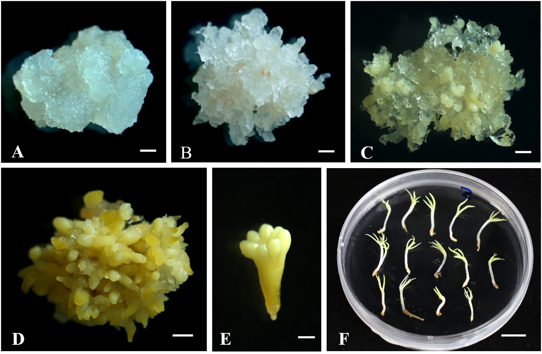 Panel of images showing stages of plant tissue culture. A, B, C: White to light yellow callus formation at different stages. D: Yellow, nodular callus. E: Yellowish elongated structure resembling an embryo. F: Petri dish containing several small seedlings with roots and shoots.