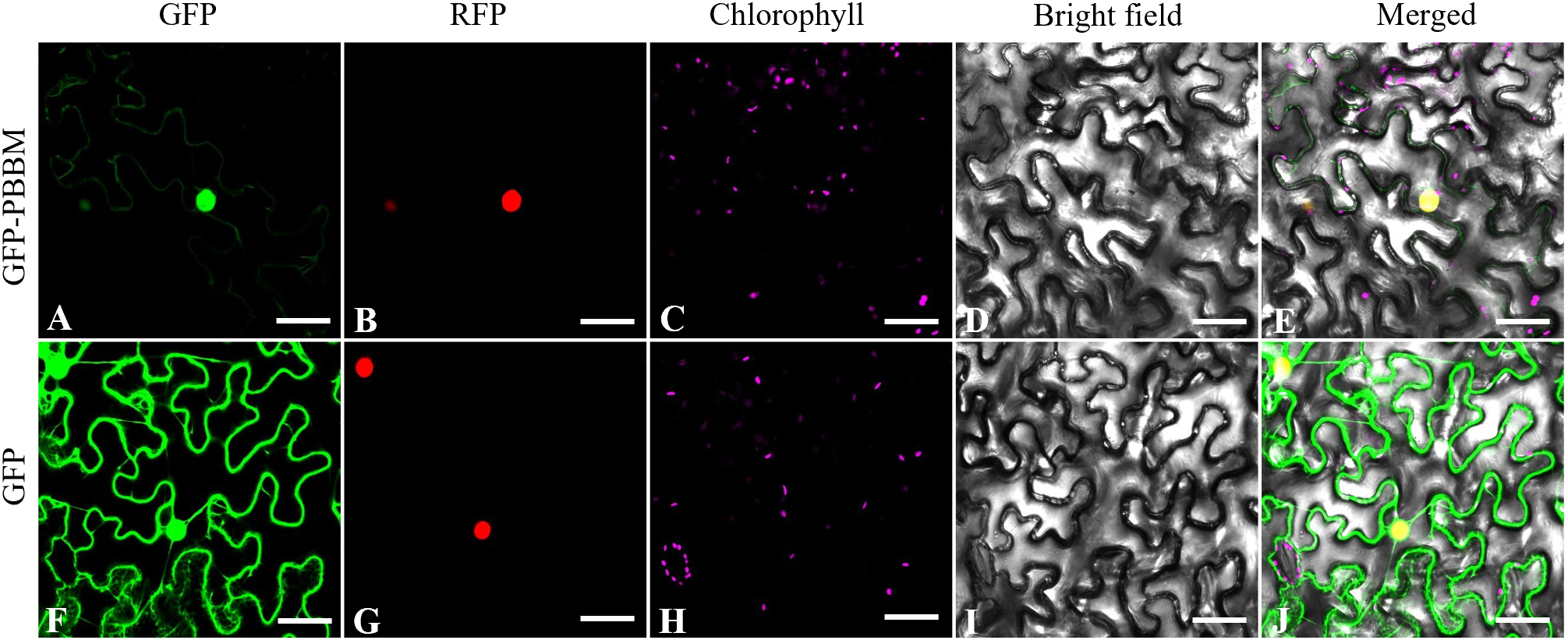 Fluorescent microscopy images display different stains and filters. Panels A to E show protein expression in green fluorescent protein (GFP)-labelled models: GFP, red fluorescent protein (RFP), chlorophyll in magenta, bright field, and merged view. Panels F to J show a similar sequence with only GFP labelling. The images reveal cellular structures and protein localization under different conditions, with each panel highlighting specific fluorescence.