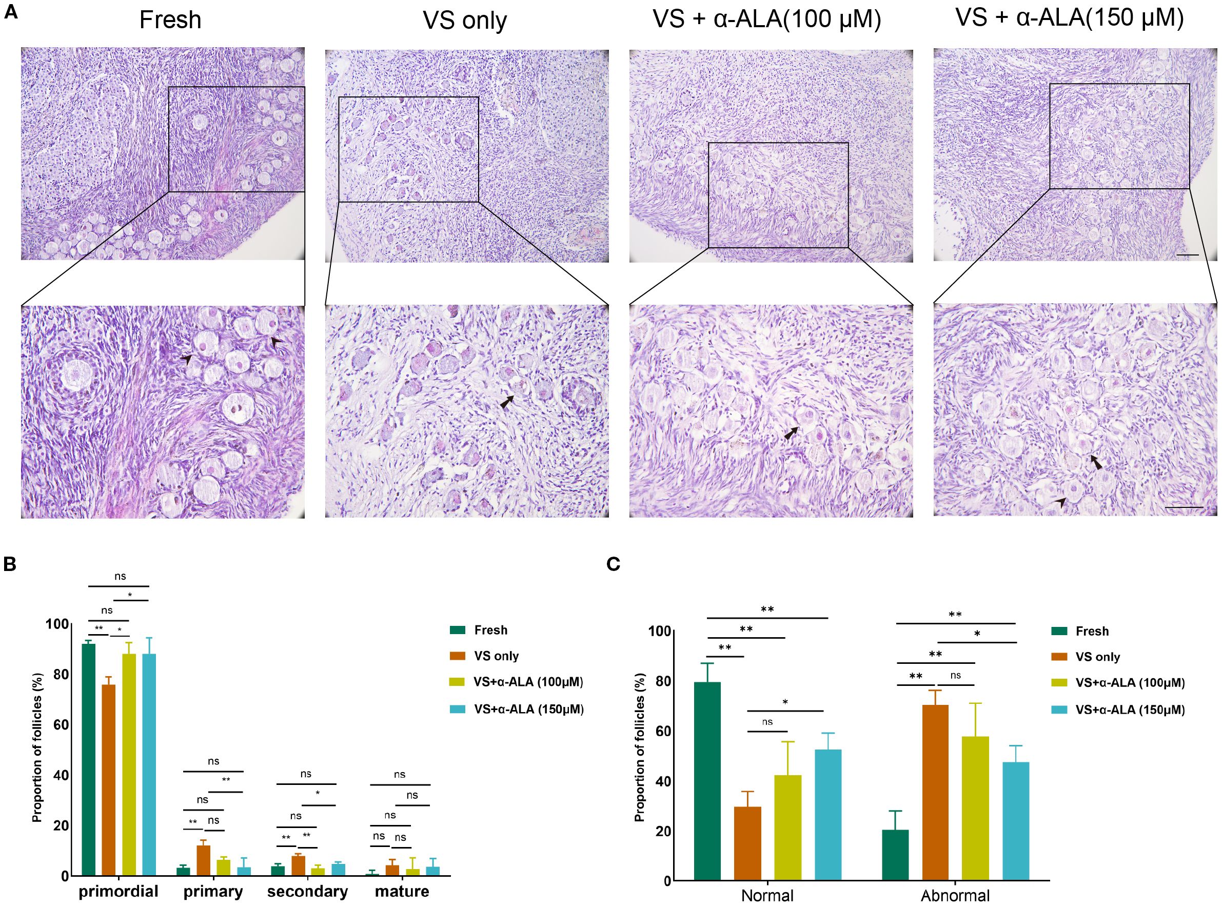 Panel A shows histological sections of ovarian tissue under different conditions with magnified areas highlighting follicle structures. Panel B is a bar graph comparing the proportion of follicles at various developmental stages across treatments: Fresh, VS only, and VS with two concentrations of α-ALA. Panel C is another bar graph comparing the proportion of normal and abnormal follicles under the same conditions, indicating statistical significance levels.