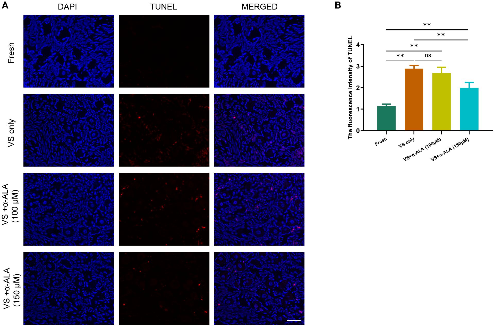 Panel A shows a series of microscopic images. Rows represent different treatments: Fresh, VS only, VS + a-ALA (100 μM), and VS + a-ALA (150 μM). Each row displays DAPI-stained nuclei in blue, TUNEL-stained apoptotic cells in red, and a merged view. Panel B features a bar graph demonstrating the fluorescence intensity of TUNEL staining across treatments. VS + a-ALA (150 μM) show lower TUNEL fluorescence intensity than the VS only group, with statistical significance marked by asterisks and “ns” for non-significance.