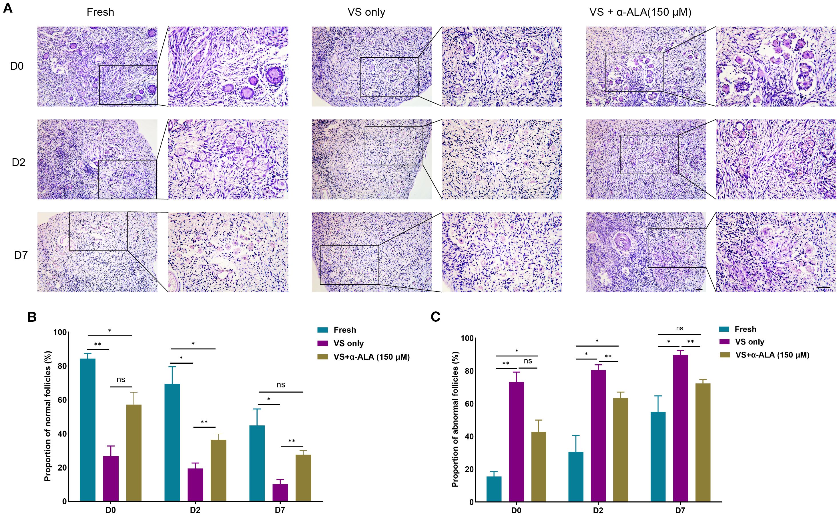 Histological images and graphs related to follicle preservation over days zero, two, and seven under three conditions: Fresh, VS only, and VS with alpha-ALA. The top row shows magnified tissue sections for each condition. The bottom row features two bar graphs: (B) shows the proportion of normal follicles, and (C) displays the proportion of abnormal follicles, with statistical significance indicated by asterisks. Blue, pink, and brown bars represent Fresh, VS only, and VS plus alpha-ALA, respectively.