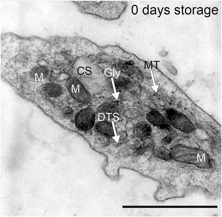 Electron microscope image showing a cell structure labeled with terms like M (possibly mitochondria), CS, Gly, DTS, and MT. The image is labeled