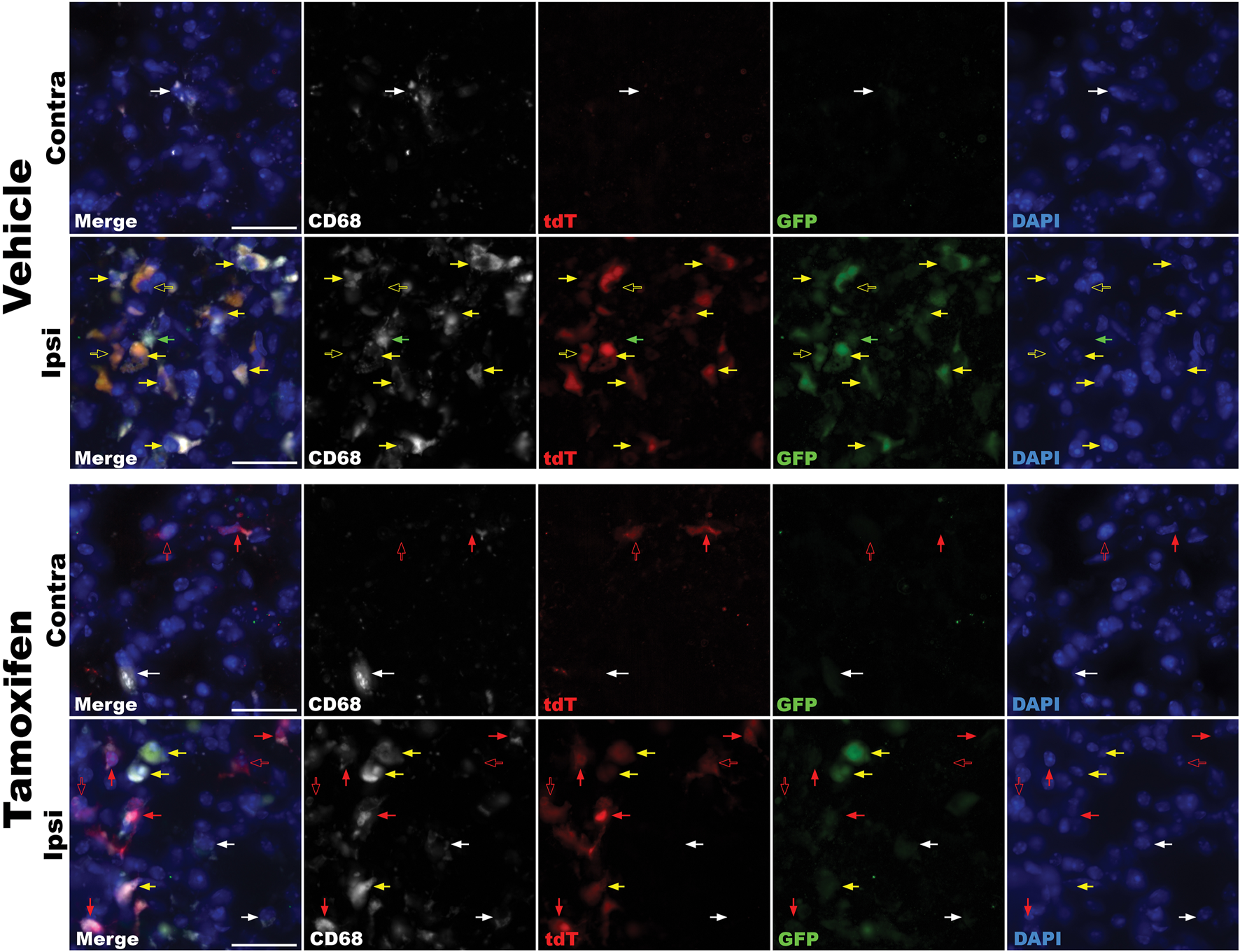Fluorescence microscopy images show brain tissue sections of LPS treated mice treated with vehicle (top) or tamoxifen (bottom). Channels are merged, CD68, tdT, GFP, and DAPI. Arrows indicate reporter gene localization.