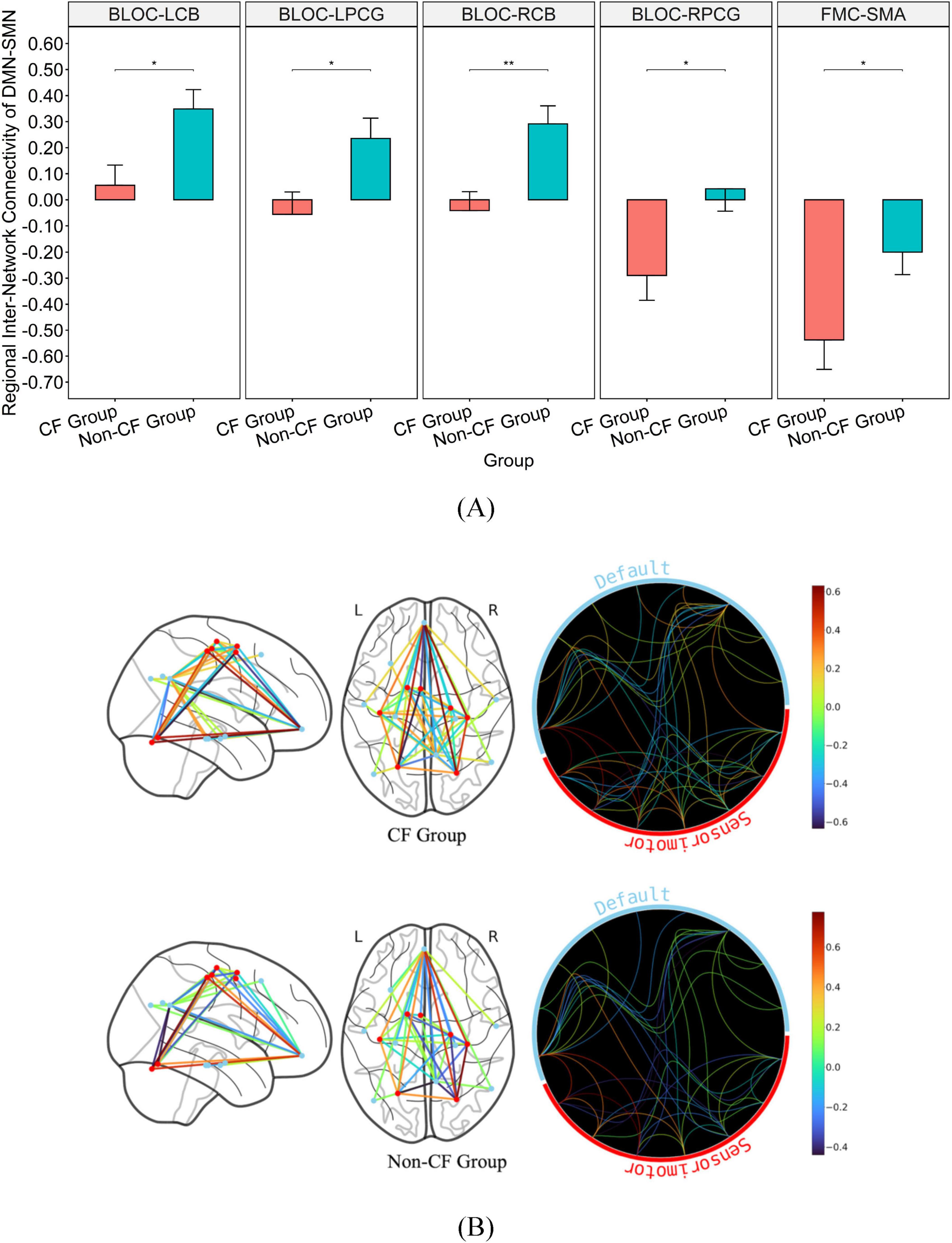 Graph A shows box plots comparing regional inter-network connectivity of DMN-SMN between CF and Non-CF groups across five brain regions, with significant differences indicated. Graph B includes diagrams with brain connectivity maps for CF and Non-CF groups, illustrating differences using colored lines. The color scale on the right represents connectivity strength.