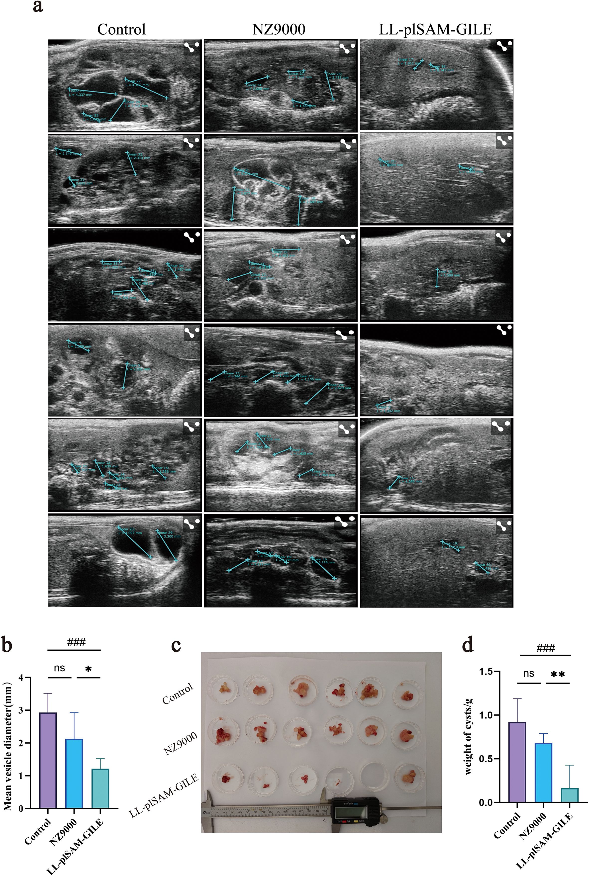 Ultrasound images (a) show vesicle measurements under different conditions: Control, NZ9000, and LL-plSAM-GILE. Bar graph (b) presents mean vesicle diameter in millimeters among the groups, indicating statistical significance. Photo (c) depicts samples of cysts from each group with a scale for measurement. Another bar graph (d) illustrates the weight of cysts in grams, highlighting differences with statistical markers.