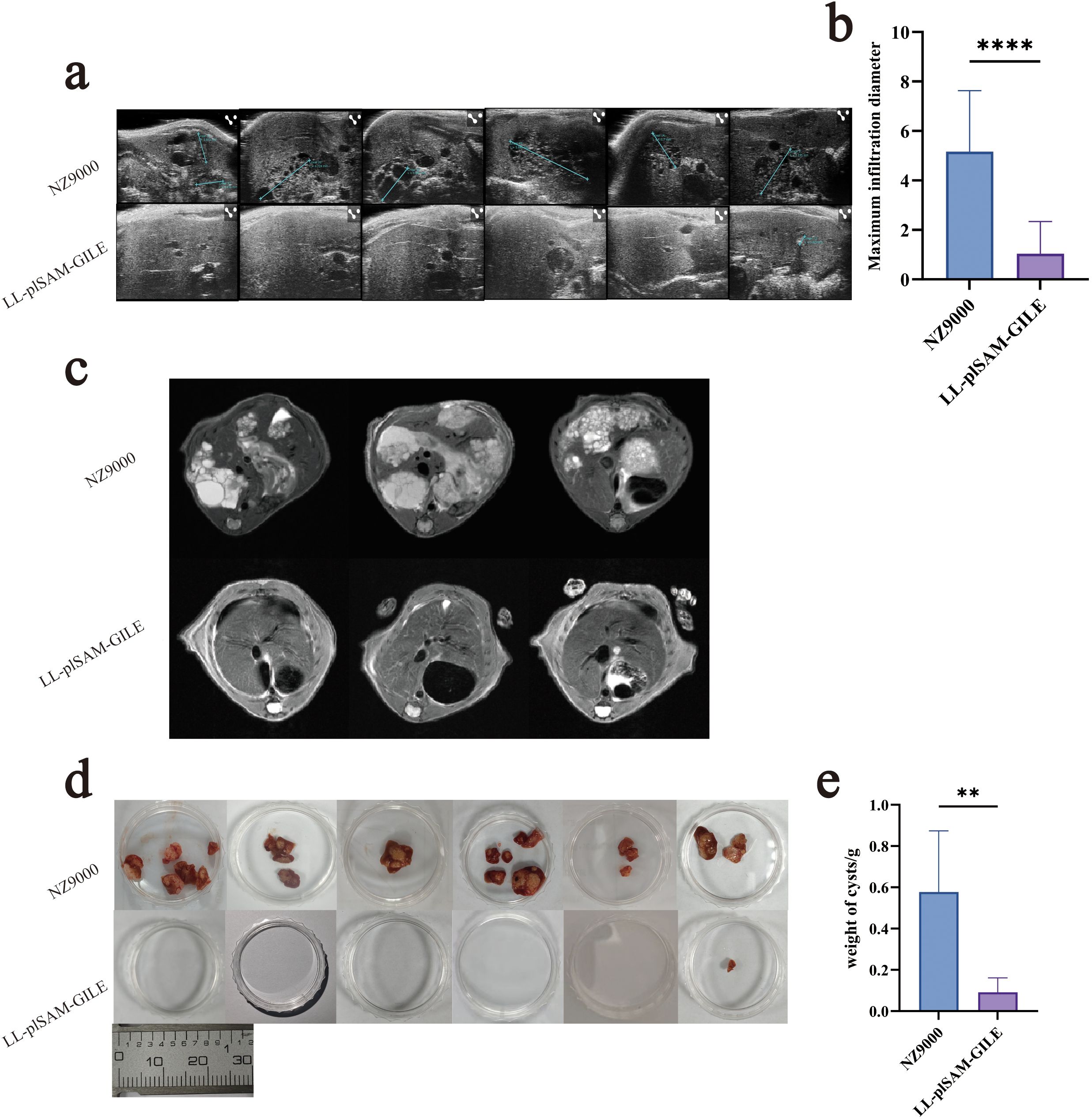 Panel a shows ultrasound images comparing NZ9000 and LL-pS1AM-GILE with annotated infiltration diameters. Panel b features a bar graph illustrating a significant reduction in maximum infiltration diameter for LL-pS1AM-GILE. Panel c presents CT scans showing visual differences between the groups. Panel d displays cyst samples in petri dishes, with visible size differences, alongside a ruler for scale. Panel e includes a bar graph demonstrating a significant decrease in cyst weight in LL-pS1AM-GILE.