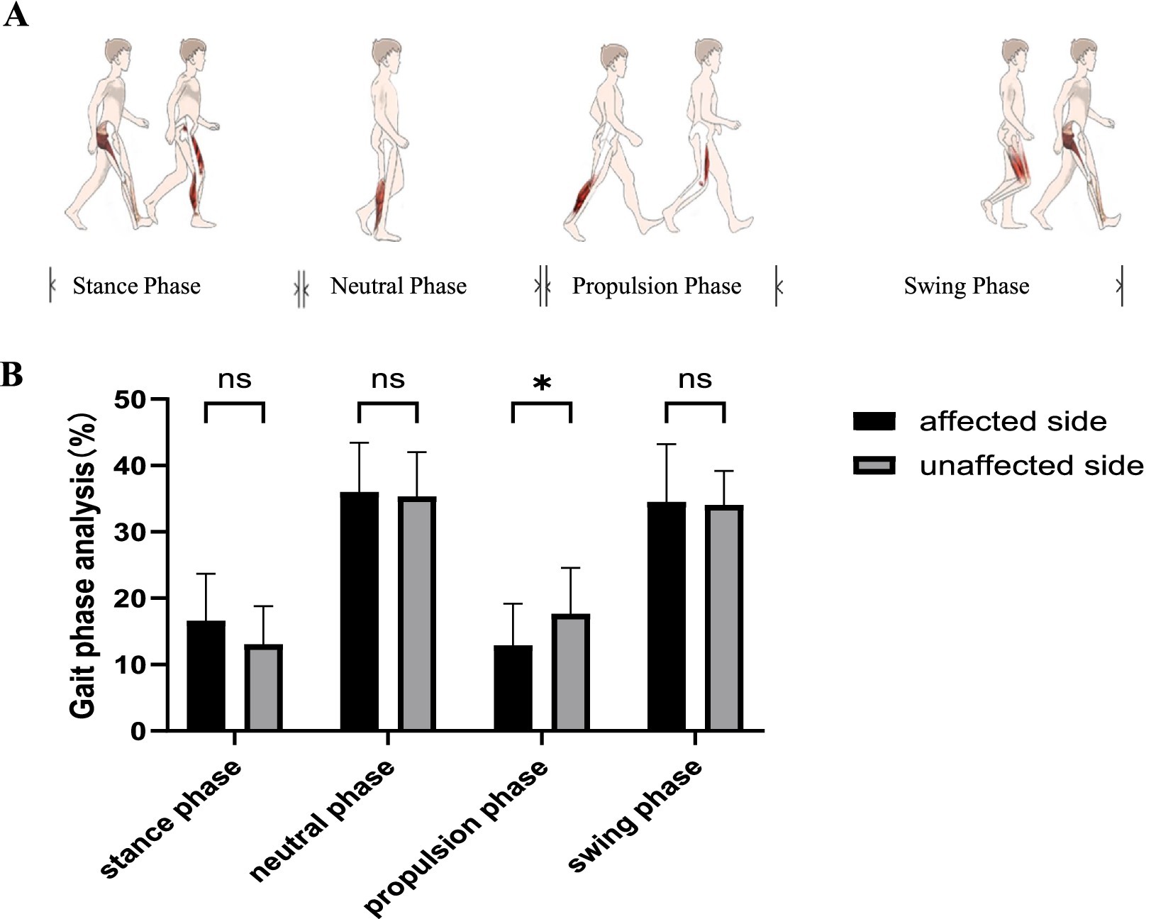 Illustration of gait phases and bar chart. Part A shows four gait phases: stance, neutral, propulsion, and swing, with muscle emphasis on legs. Part B is a bar chart comparing affected and unaffected sides across these phases, using percentages. No significant difference is noted between most phases except propulsion, marked with an asterisk.